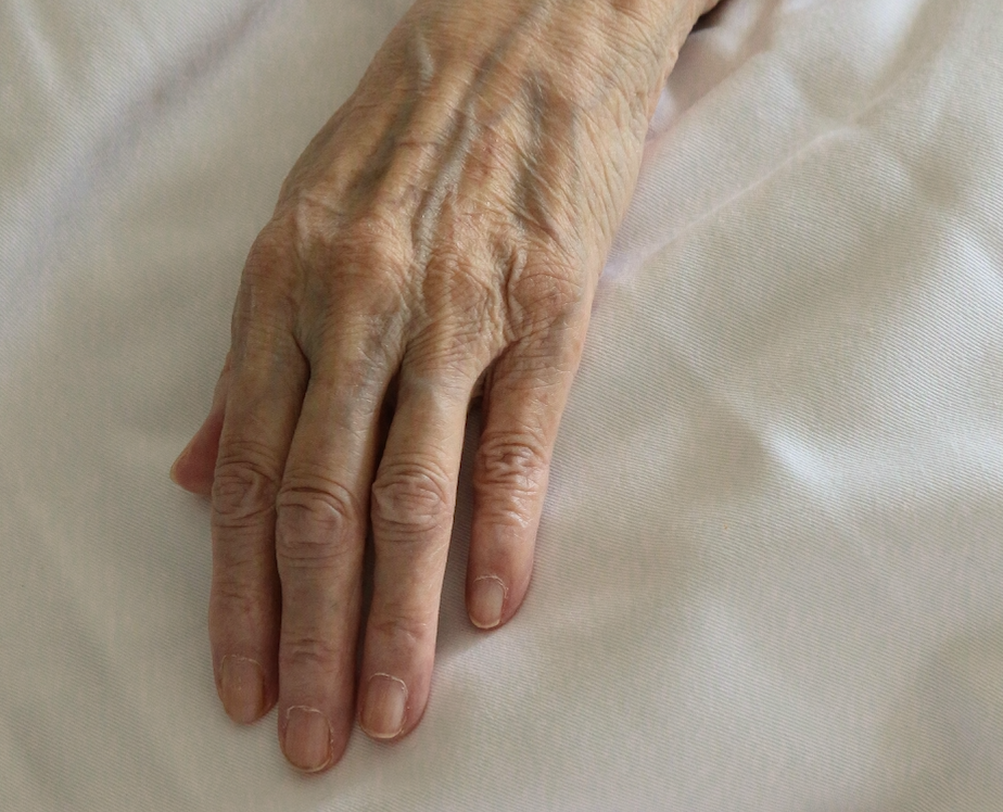 Przeziębienie u osoby starszej - jak sobie z nim poradzić?